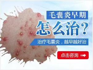 毛囊炎挤压后变大了怎么办