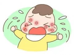 反复过敏是免疫力低吗