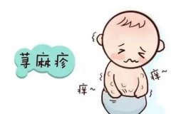 丘疹性荨麻疹怎么治疗